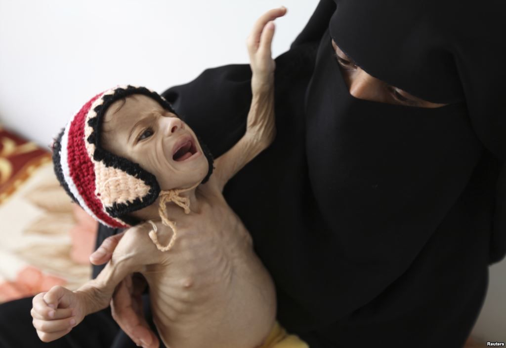 yemen crisis
