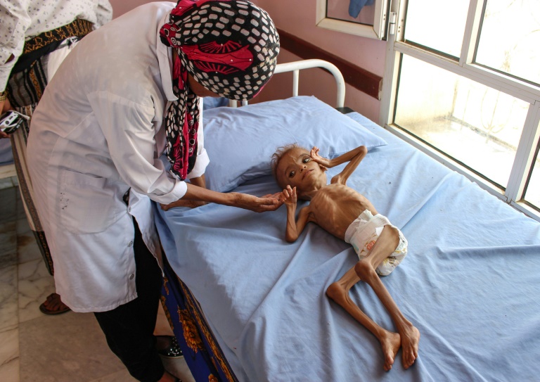 ООН «проигрывает борьбу с голодом» в Йемене