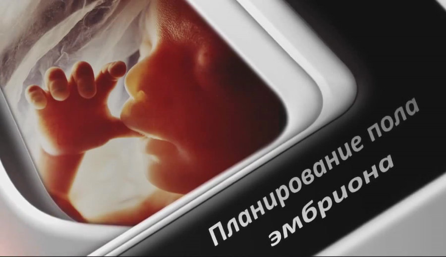Фикх: Планирование пола эмбриона